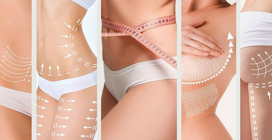 LOOKING FOR BODY SCULPTING NEAR ME? WE COMPARE THE TOP 5 HERE - TLC Medispa  & SkinStore