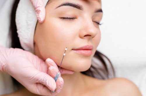 Relaxed Young Female Getting PDO Thread Lift Treatment | Imagine Medspa in Winter Garden, FL