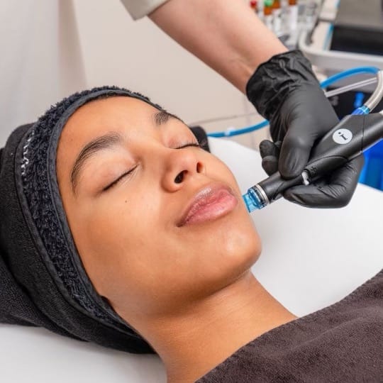 Before and After Images at Imagine Medspa in Winter Garden, FL