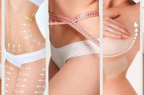 Body Sculpting Treatments By Imagine Medspa in Winter Garden, FL