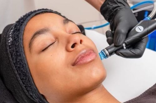 Before and After Images at Imagine Medspa in Winter Garden, FL