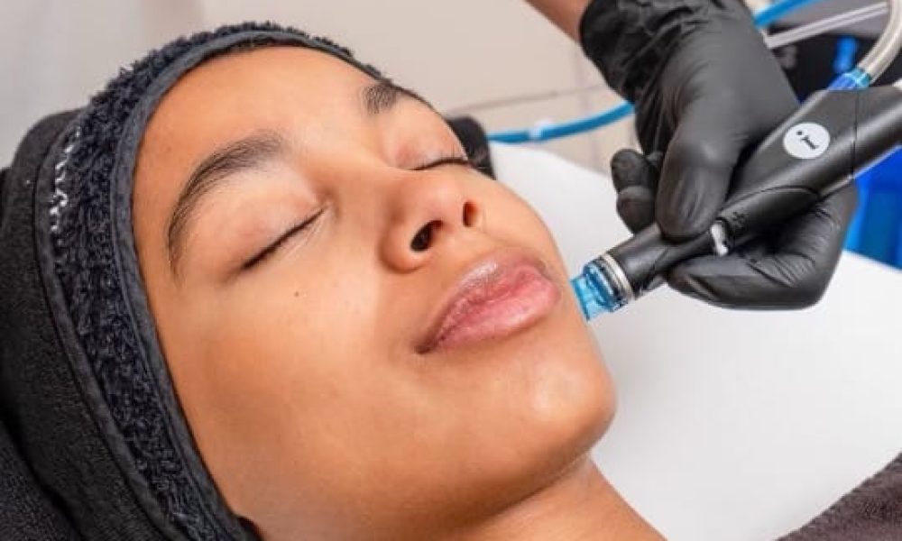 Before and After Images at Imagine Medspa in Winter Garden, FL